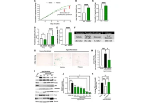 Psilocybin treatment extends cellular lifespan, improves survival of aged mice