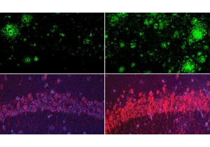 Lithium Reverses Alzheimer's in Mice