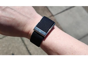 Users of the new Whoop MG fitness band are reporting widespread failures