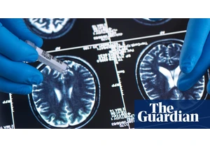 Younger generations less likely to have dementia, study suggests