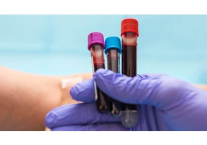 Stay on Top of These 6 Blood Tests to Make Sure You're Monitoring Your Health