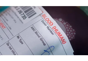 What’s Your Blood Type? This Is How It Can Affect Your Heart Health