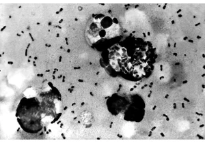 Arizona resident dies from the plague less than 24 hours after showing symptoms