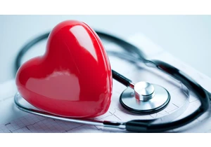 Stroke Awareness: These 4 Letters Can Help You Save Lives