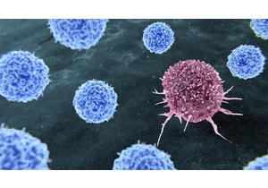 Scientists 3D print tumors for cancer research — TissueTinker using 3D bioprinting to create miniature models of healthy and diseased tissue for side-by-side comparison, backed by McGill