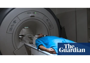 Millions in west don't know they have aggressive fatty liver disease, study says