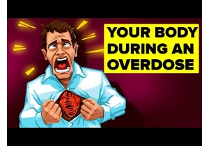 What Happens When You Overdose