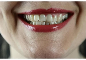 The world’s first tooth-regrowing drug has been approved for human trials