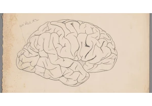 E.A. Spitzka's Studies of Exceptional and Deviant Brains (2024)