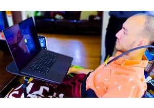 Synchron vs. Neuralink: BCI Brain Implants Compared video