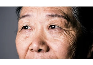 Eye Health and Older Age: How These 6 Conditions May Become More Common