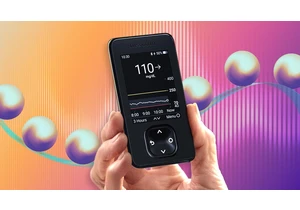The Dexcom Continuous Glucose Monitor Receiver Recall: What You Need to Do to Stay Safe