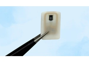 MIT engineers 3D print implant for diabetic patients that releases medicine under the skin — chip can be wirelessly activated to melt an alloy that releases powdered glucagon