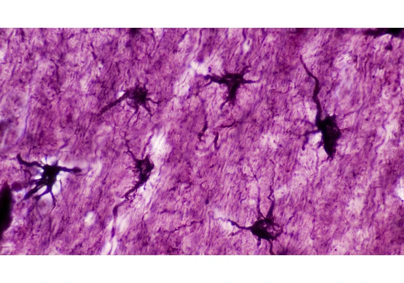 Tweaking non-neural brain cells can cause memories to fade