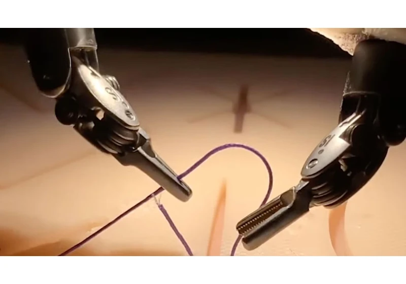 Robotic AI performs successful surgery after watching videos for training
