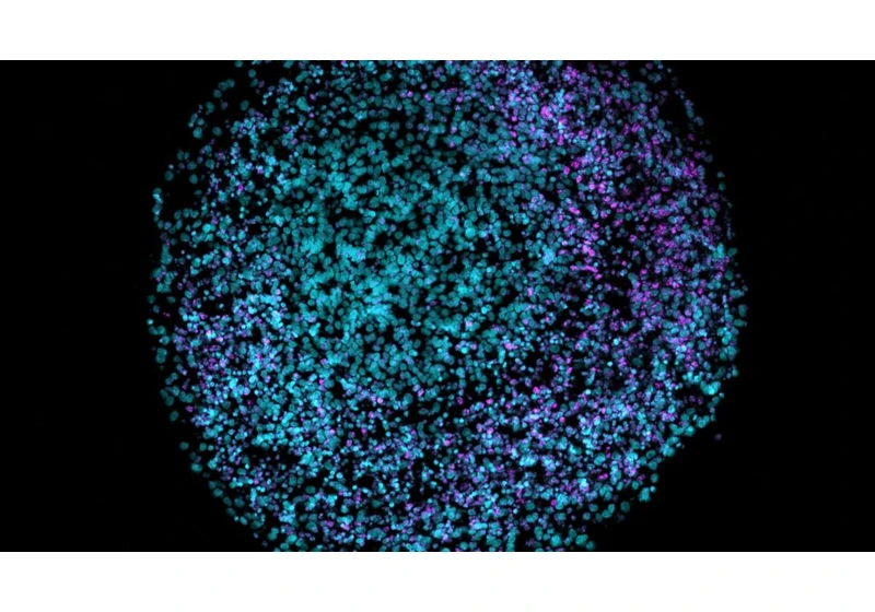 Scientists find links between Alzheimer's, herpes, and head trauma