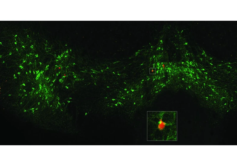 Dopamine signals when a fear can be forgotten