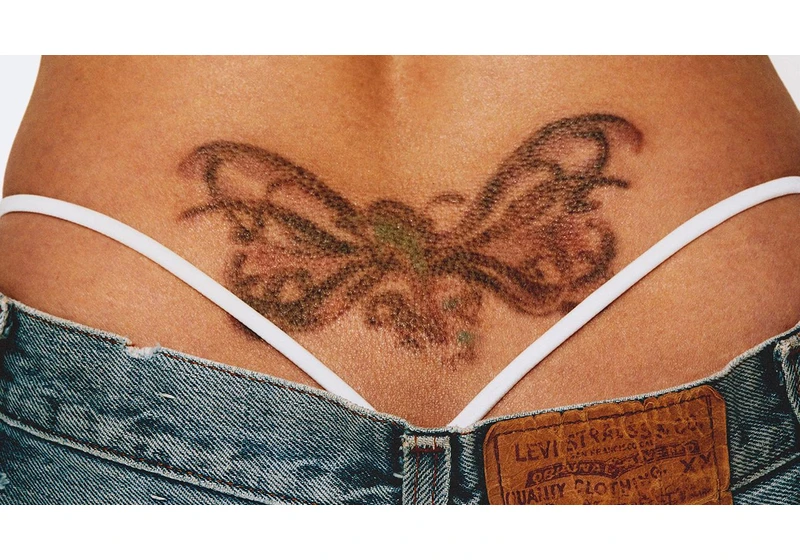 More people are getting their tattoos removed