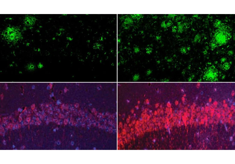 Lithium Reverses Alzheimer's in Mice