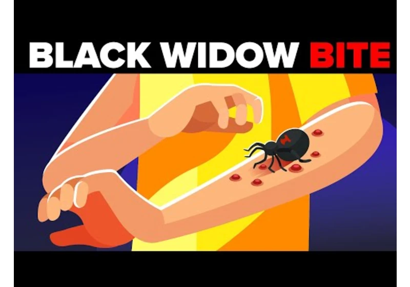Black Widow Spider Bites - How Painful is it (What Actually Happens to Your Body)?