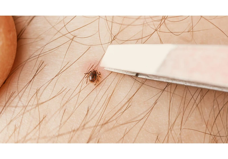 This Tick Removal Hack Doesn't Require Tweezers