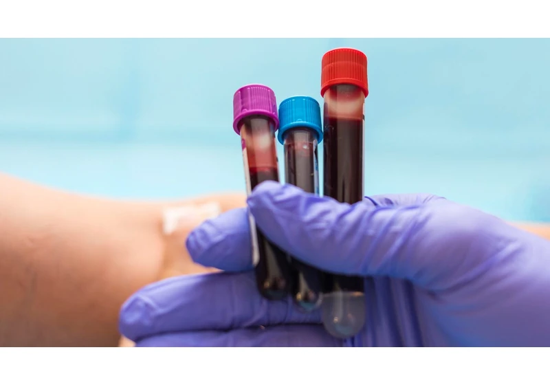 Stay on Top of These 6 Blood Tests to Make Sure You're Monitoring Your Health