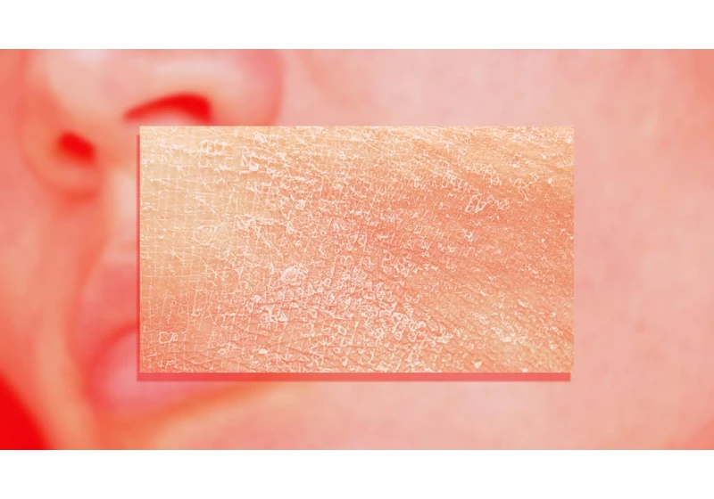 The ‘Caveman Method’ is the latest viral skincare technique. Experts say you should think twice