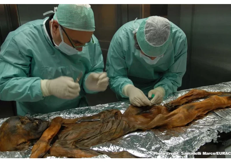 Ötzi the Lyme Mummy (2019)