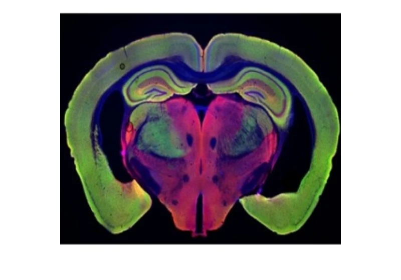 Na Alzheimera s frekvencí 40 Hz?