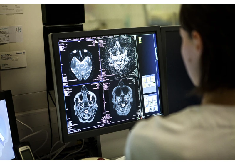 The FDA has reportedly approved an AI product that predicts cognitive decline