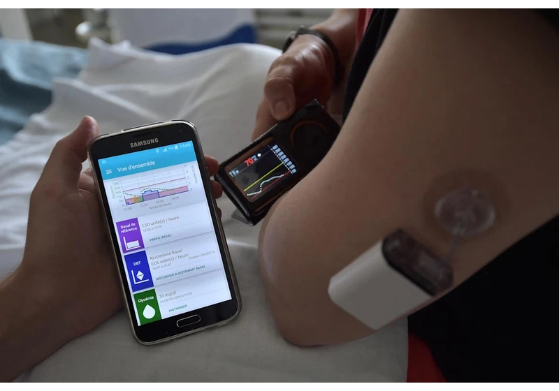 England’s NHS will provide artificial pancreas to thousands of diabetes patients