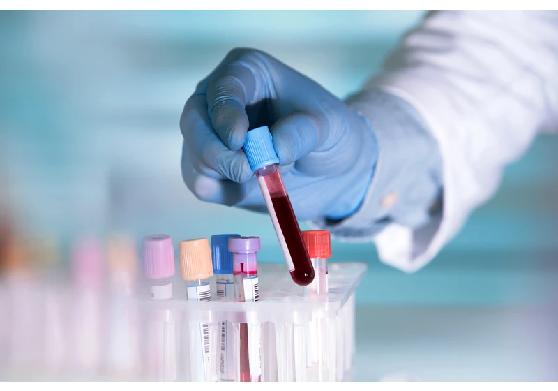 Japanese Scientists Develop Artificial Blood Compatible with All Blood Types