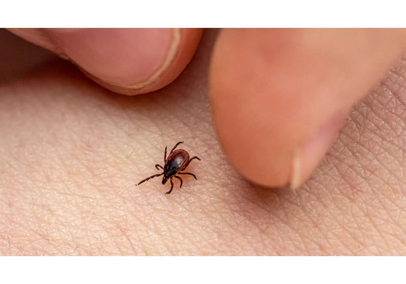 Tick Bite? Here's What to Know About Lyme Disease and Your Next Steps