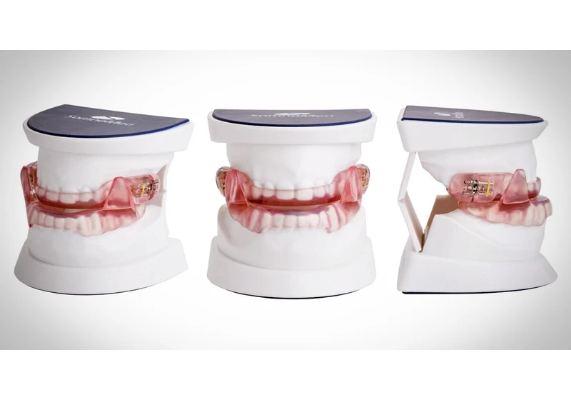 Sleep apnea: Mouthguards less invasive, just as effective as CPAP