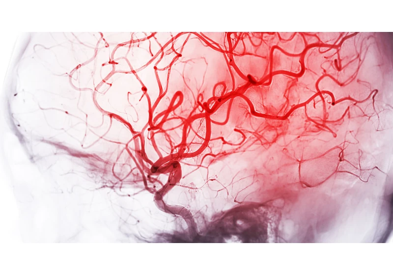 How the brain increases blood flow on demand