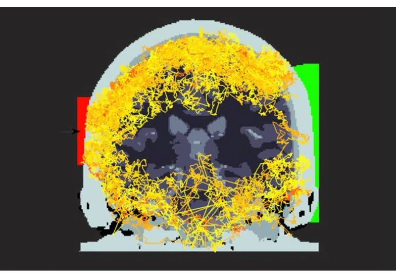 Scientists Shine a Laser Through a Human Head