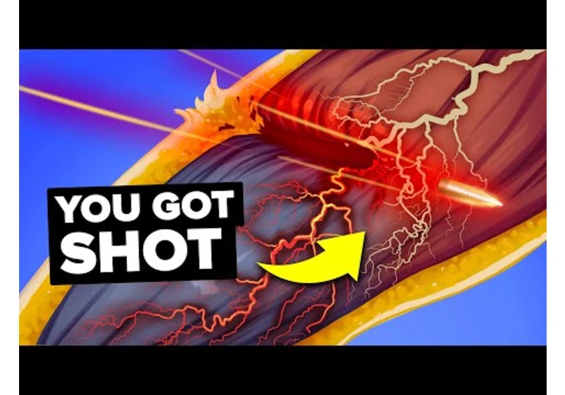 Most Painful Places to be Shot