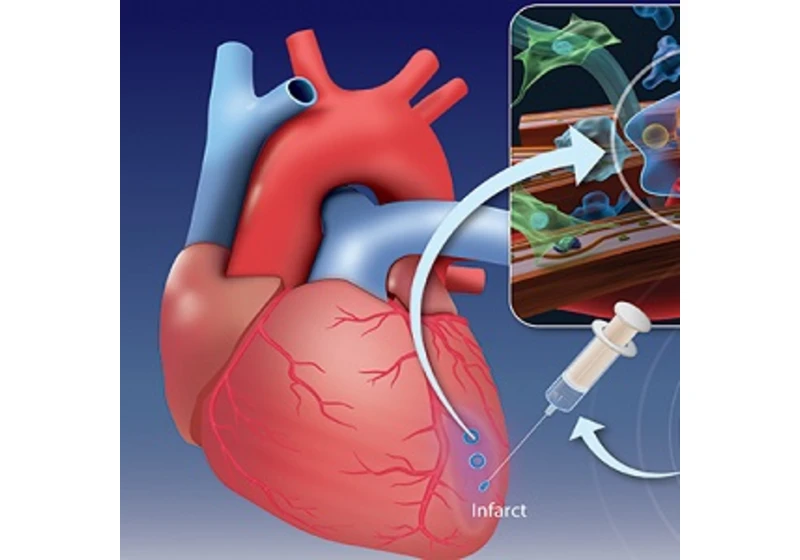 Na infarkt hydrogelem aneb postischemický remodeling