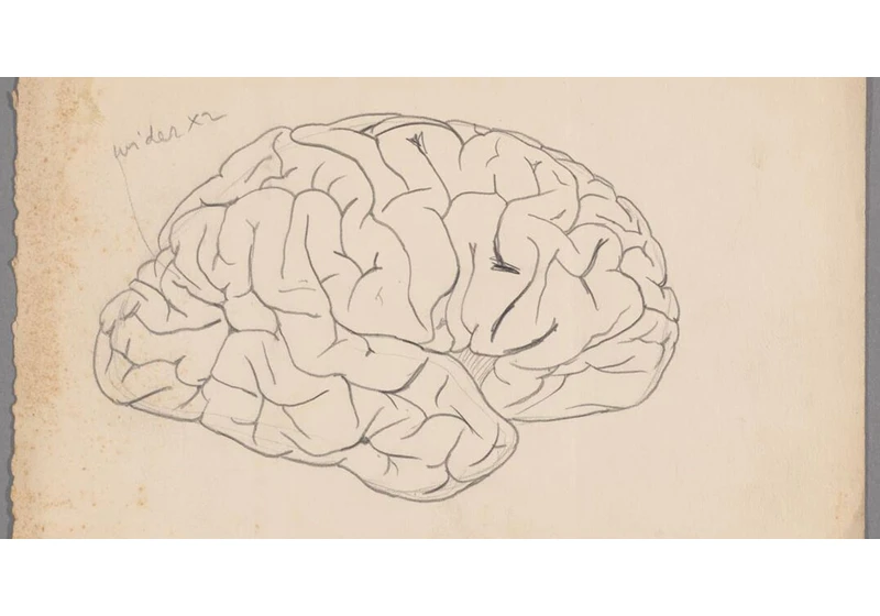 E.A. Spitzka's Studies of Exceptional and Deviant Brains (2024)