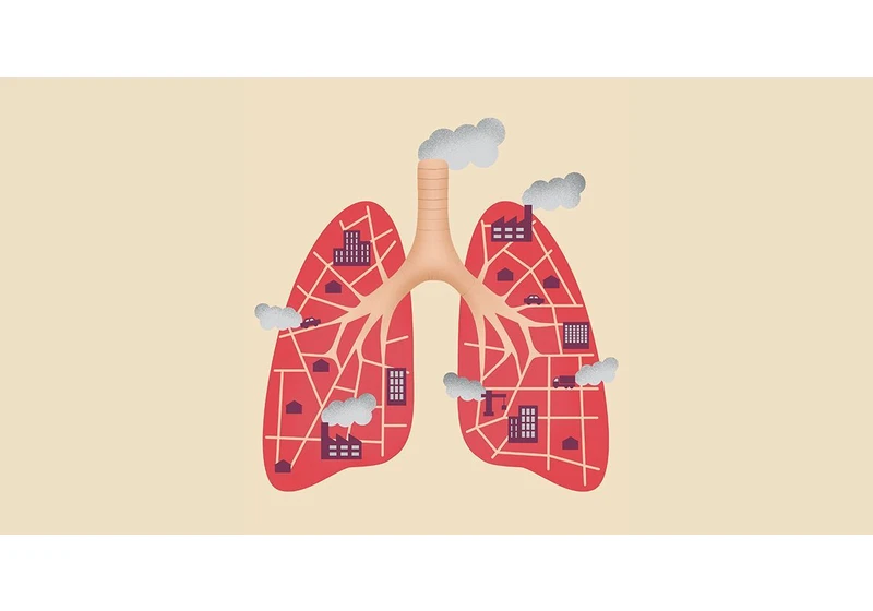 Air Pollution May Contribute to Development of Lung Cancer in Never-Smokers