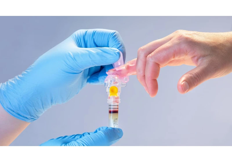 Behind an innovative new blood testing technology that, unlike Theranos, is real