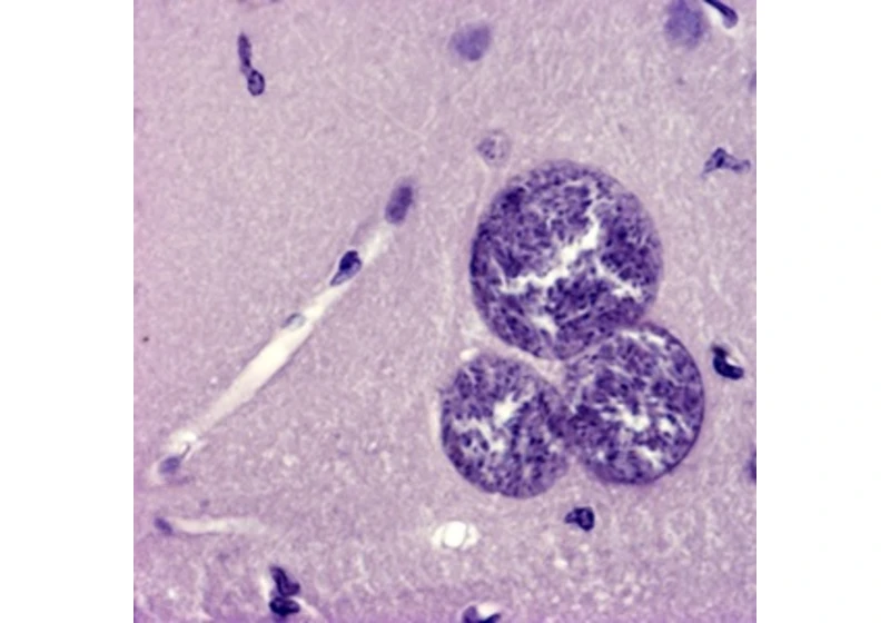 Neviditelná ruka parazita: Jak Toxoplasma a Borrelia přetvářejí naše životy